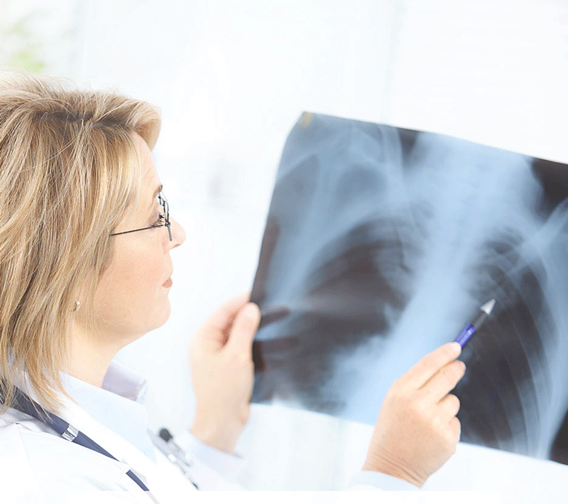 بازیافت نقره از فیلم رادیولوژی